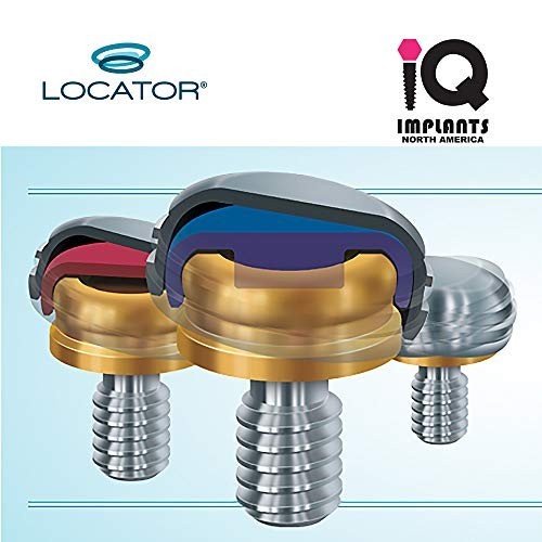Replacement Male Retention Inserts Caps for IQ Implants – Standard, Light Retent