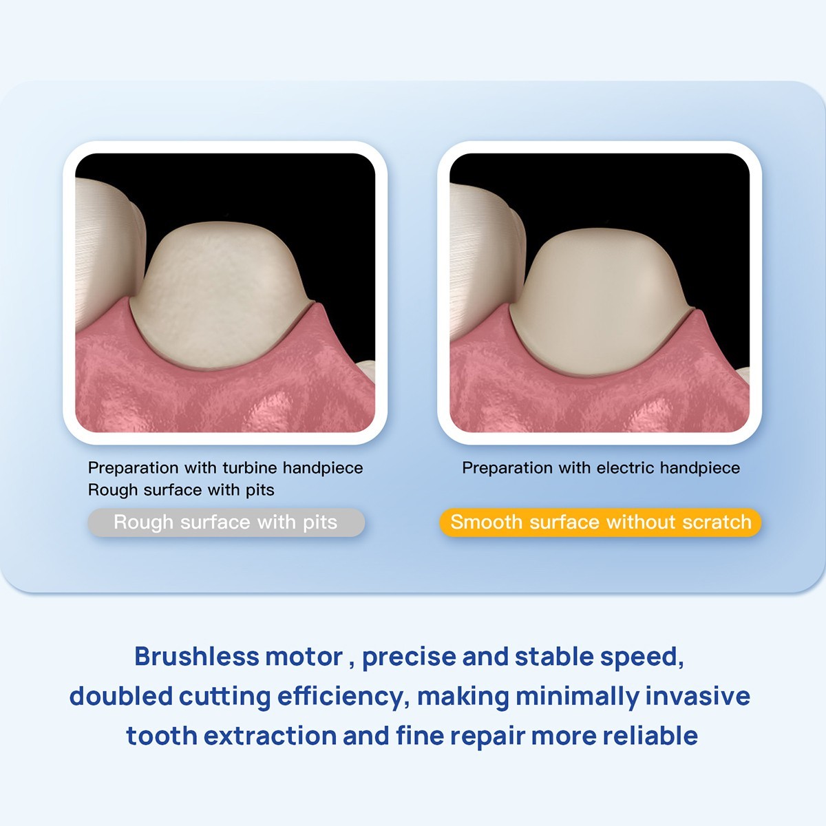 Dental Brushless LED Electric Micro Motor 1:4.2 Increasing Handpiece AZDENT