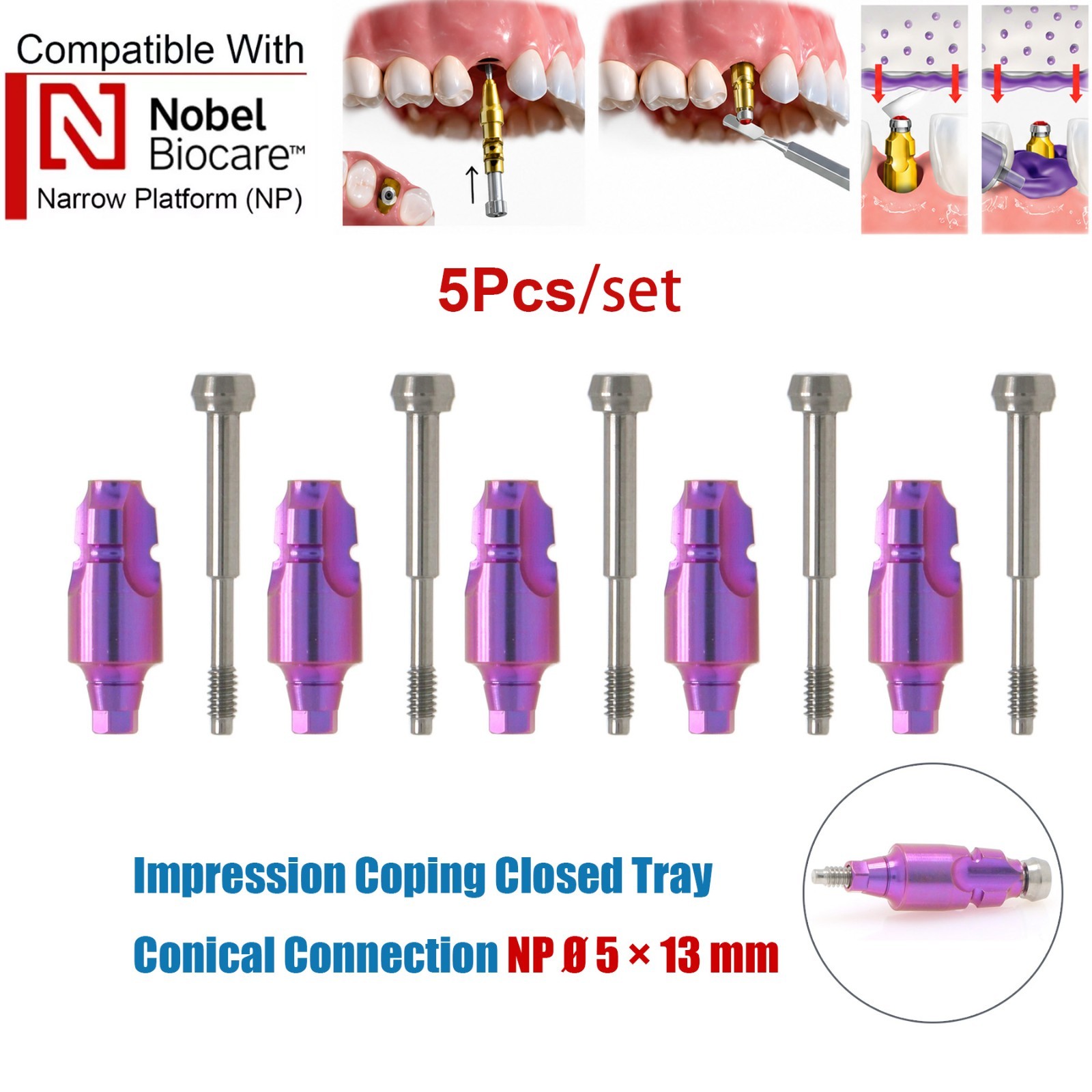 US 5Pcs Nobel Scan Body Analog Open Closed Tray Impression Transfer Conical Hex