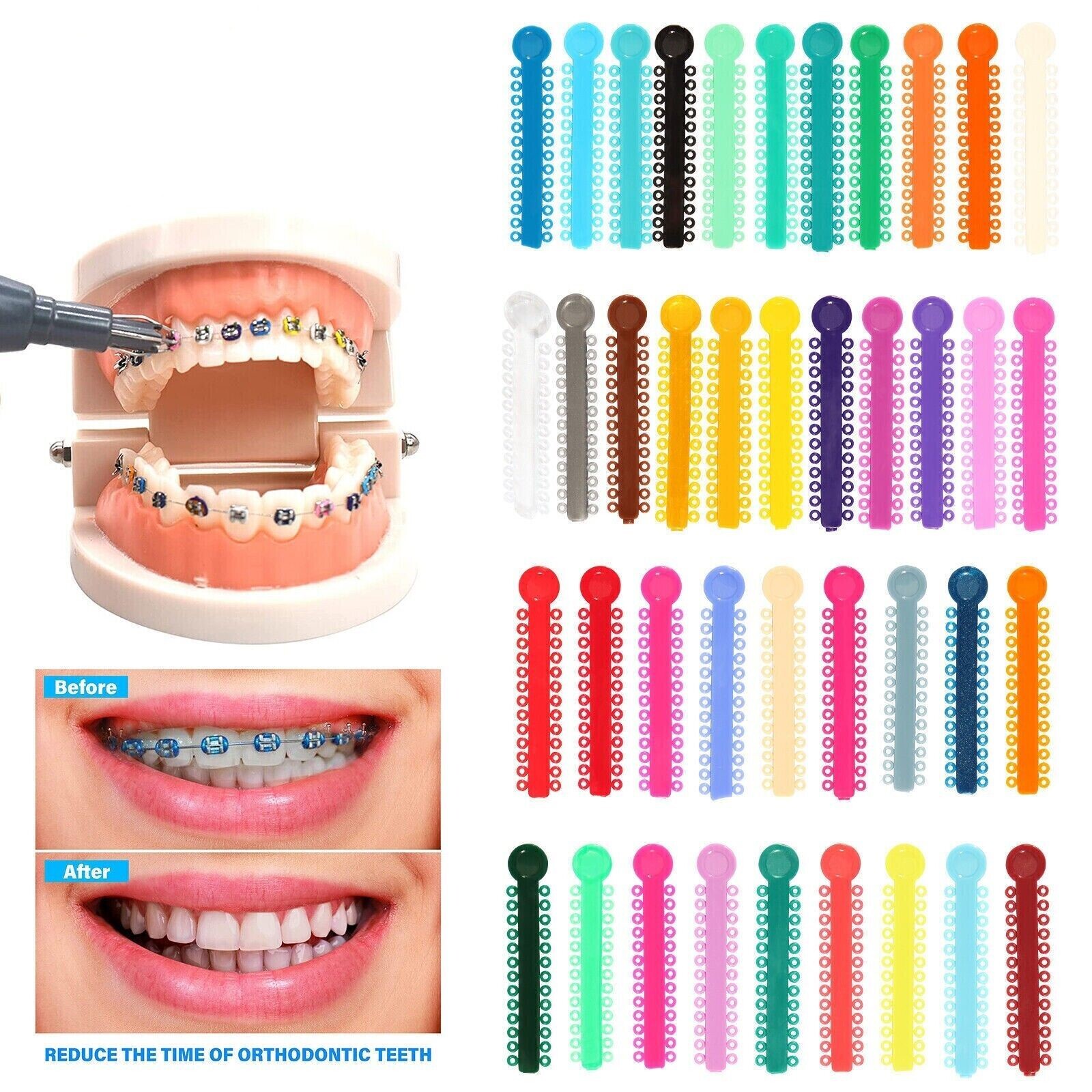 45 Colors Dental Orthodontic Ligature Ties Elastic Latex Bands 1040 Pcs/Pack