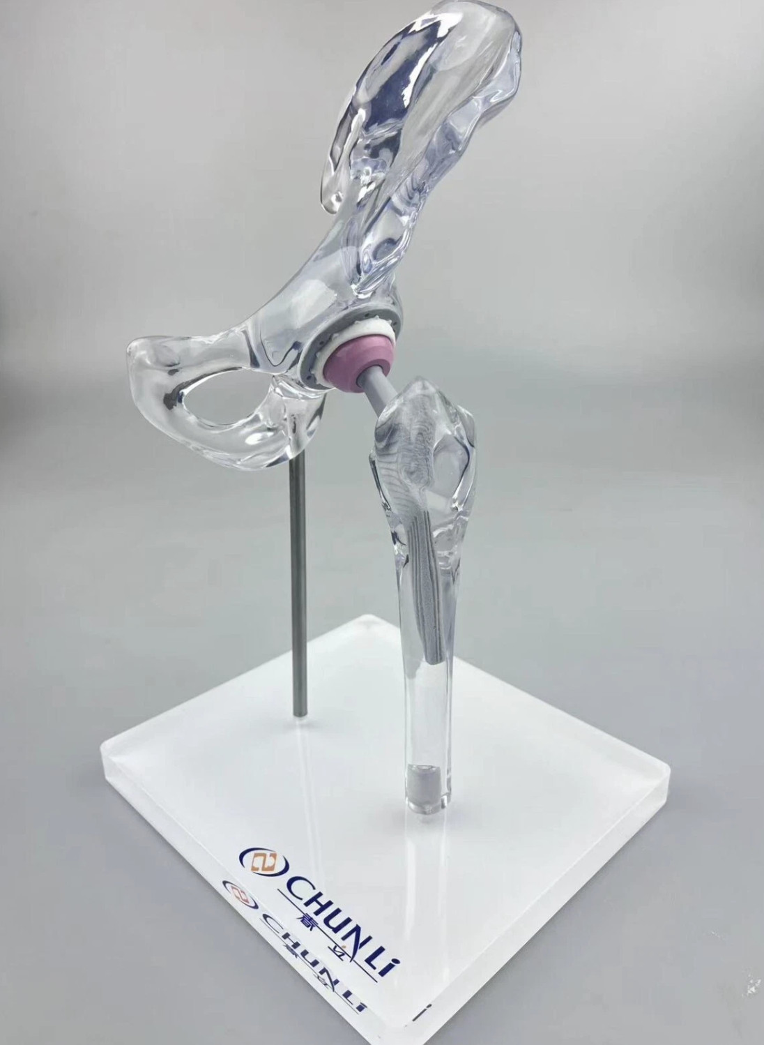 Transparent 1/3 Artificial Hip Joint Replacement Medical Anatomical Demo Model