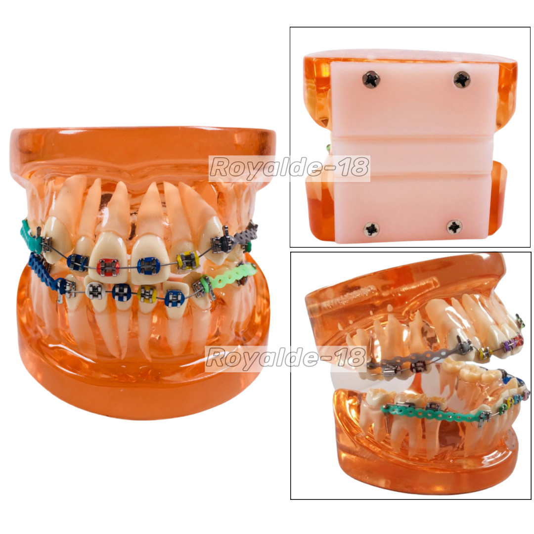 DAMON 30Packs Dental Orthodontic Arch Wires Stop Copper Cu-Niti Study Model Wire