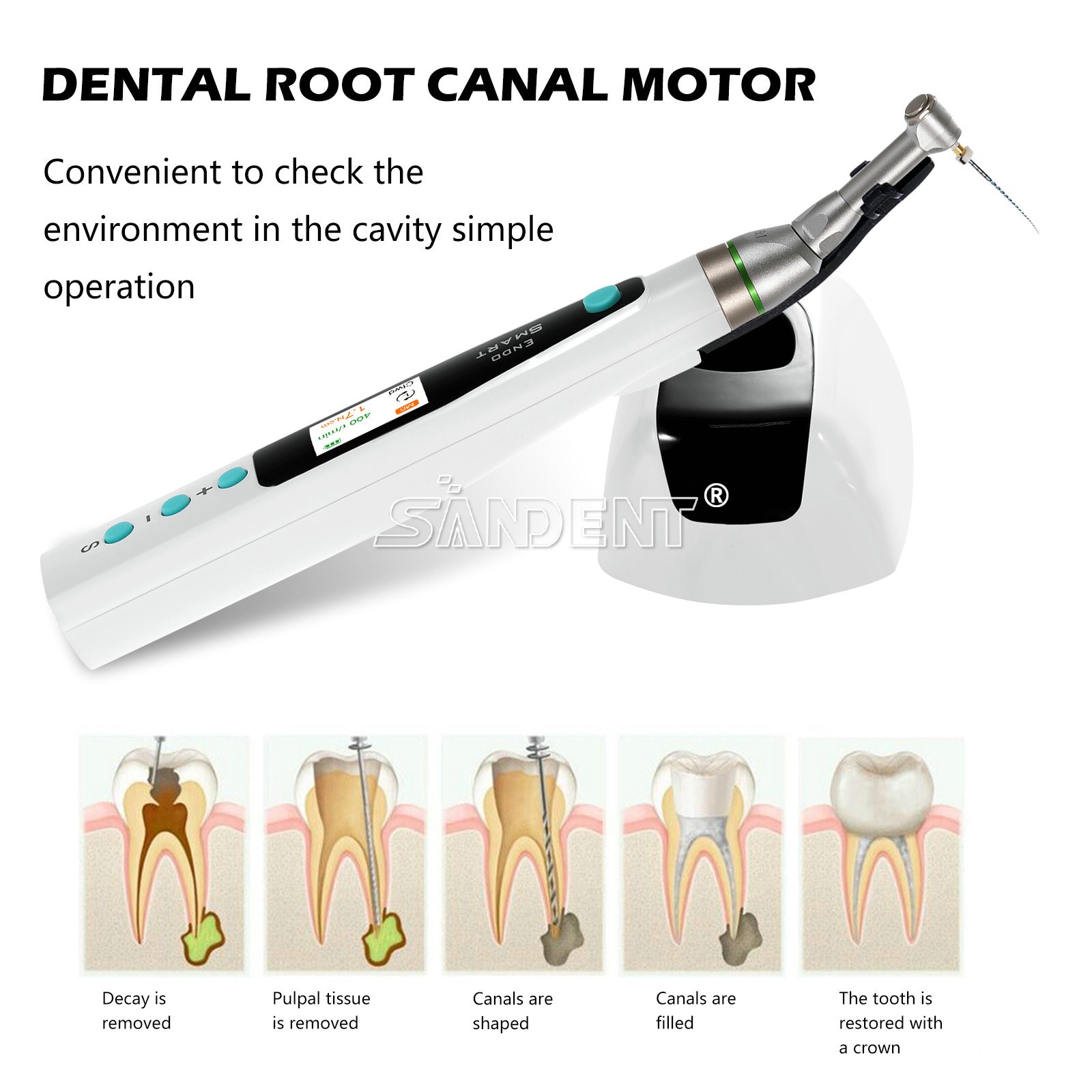 Smart Reciprocating LED Dental Endo Motor Root Canal Cordless / 1:1 16:1 Head