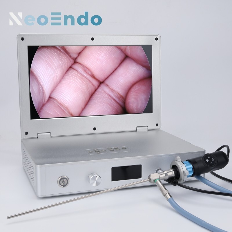 HD Portable Medical Endoscope Camera With 15.6 Inch Monitor 80W Light Source