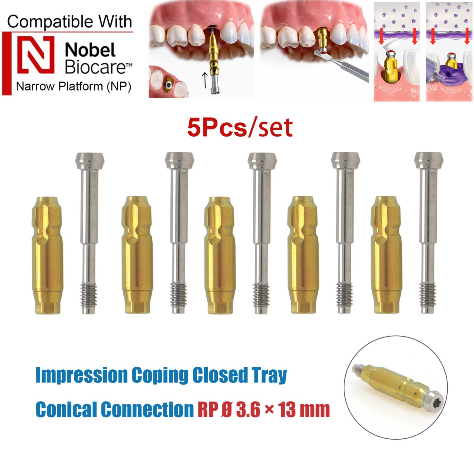 US 5Pcs Nobel Scan Body Analog Open Closed Tray Impression Transfer Conical Hex