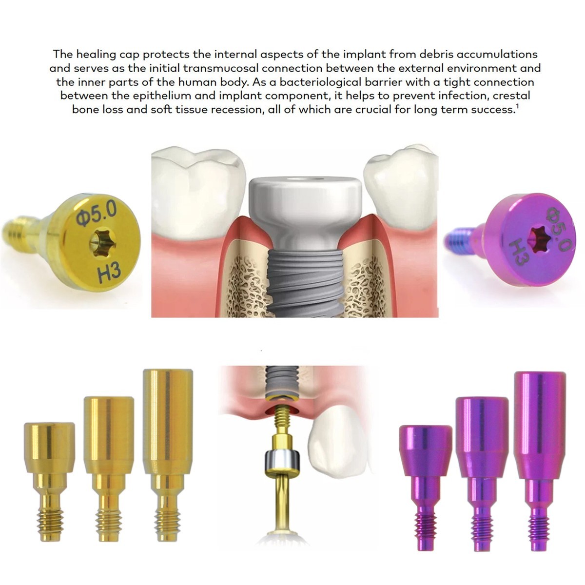 US Nobel Active Nobel Parallel CC Healing Abutment Compatible Conical Connection