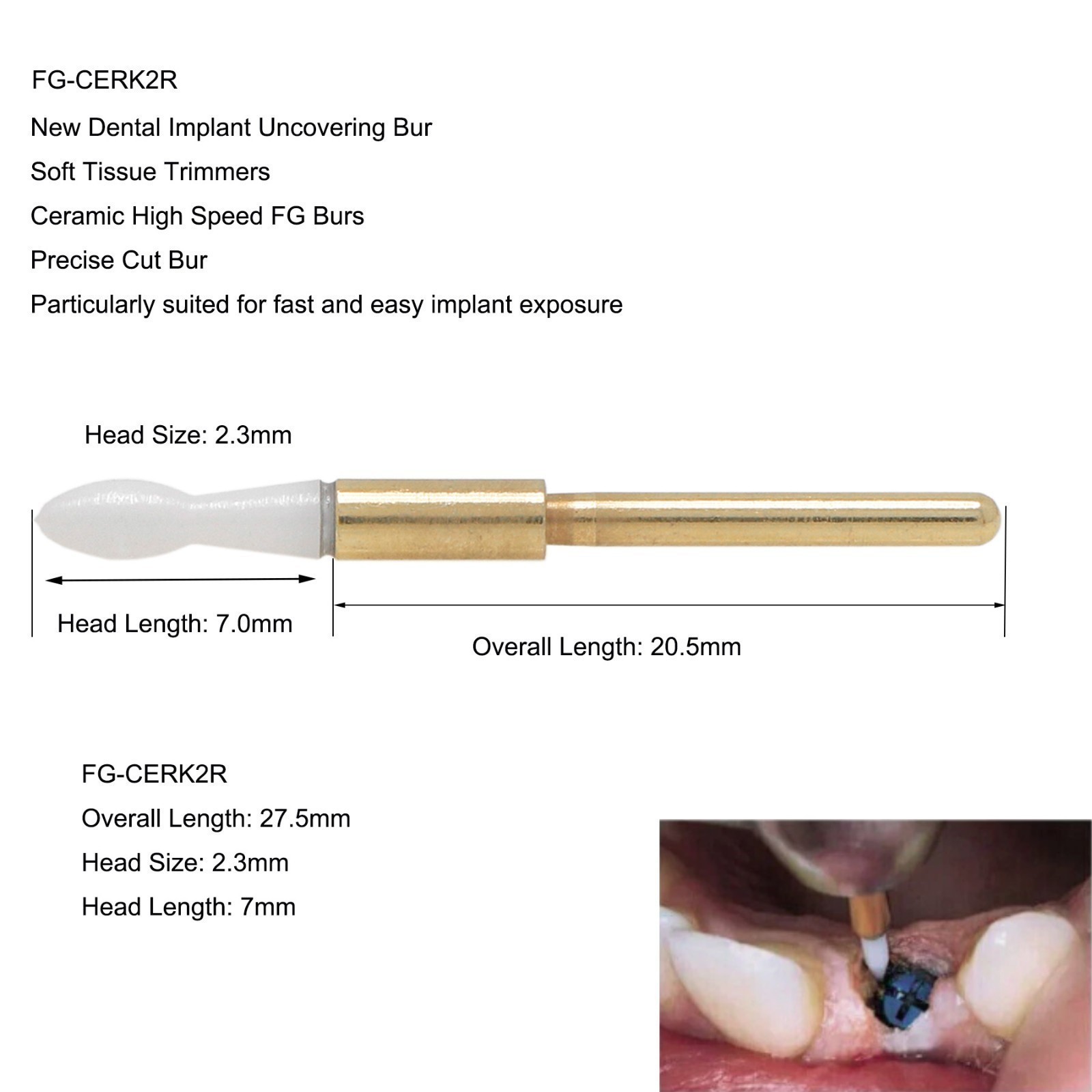 Dental Surgical Ceramic Soft Tissue Trimmer Bur for Gingivectomy – FG