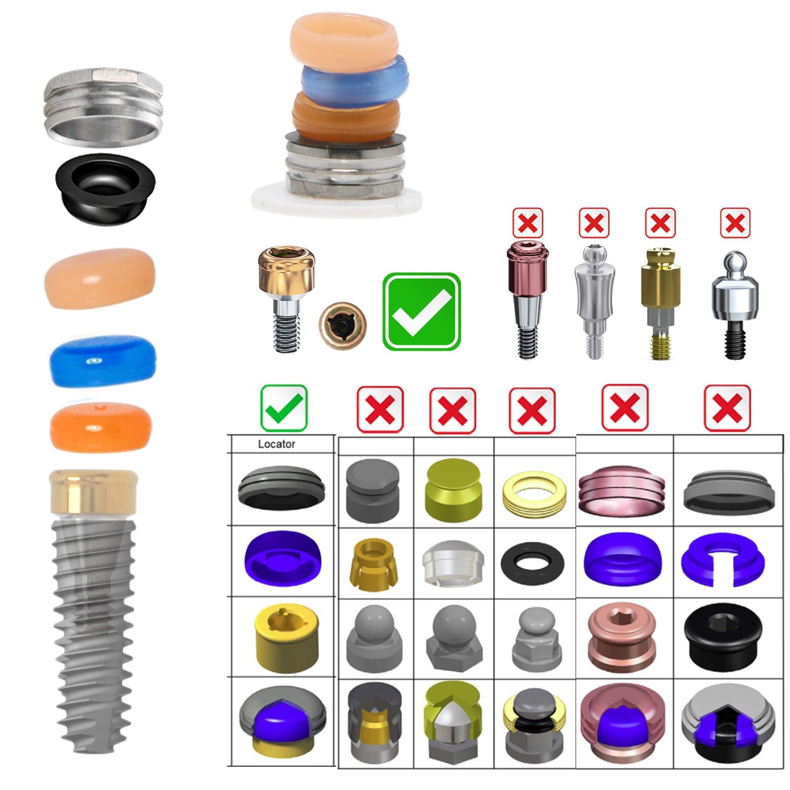 US Overdenture Locator Abutment Removable Male Cap Inserts Standard/Extended Set