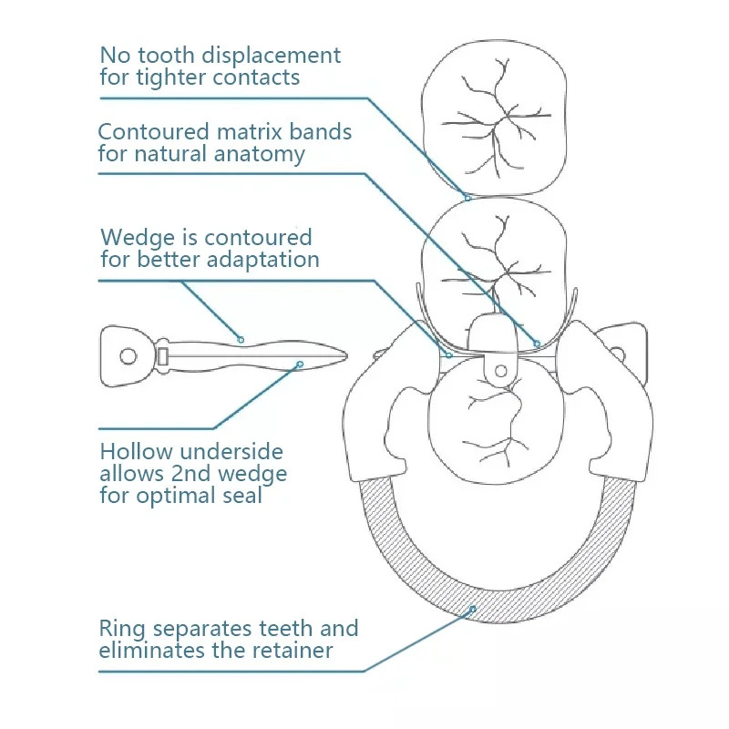 Dental Matrix Bands Ring Palodent V3 Sectional Matrix System Diastema Wedge Kit