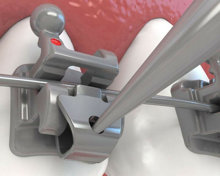 Self Ligating Orthodontic Bracket Kit -Morelli- SLI Roth 0.22 20pcs Case