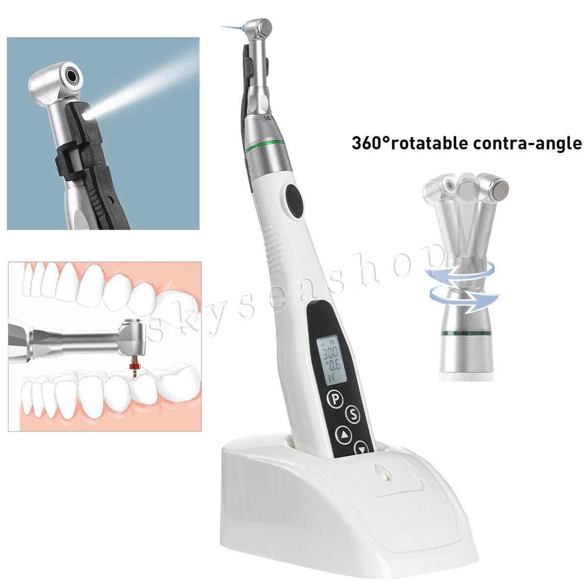 LED Dental Endo Motor 16:1 Contra Angle Root Canal Treatment Y-smart /NITI Files