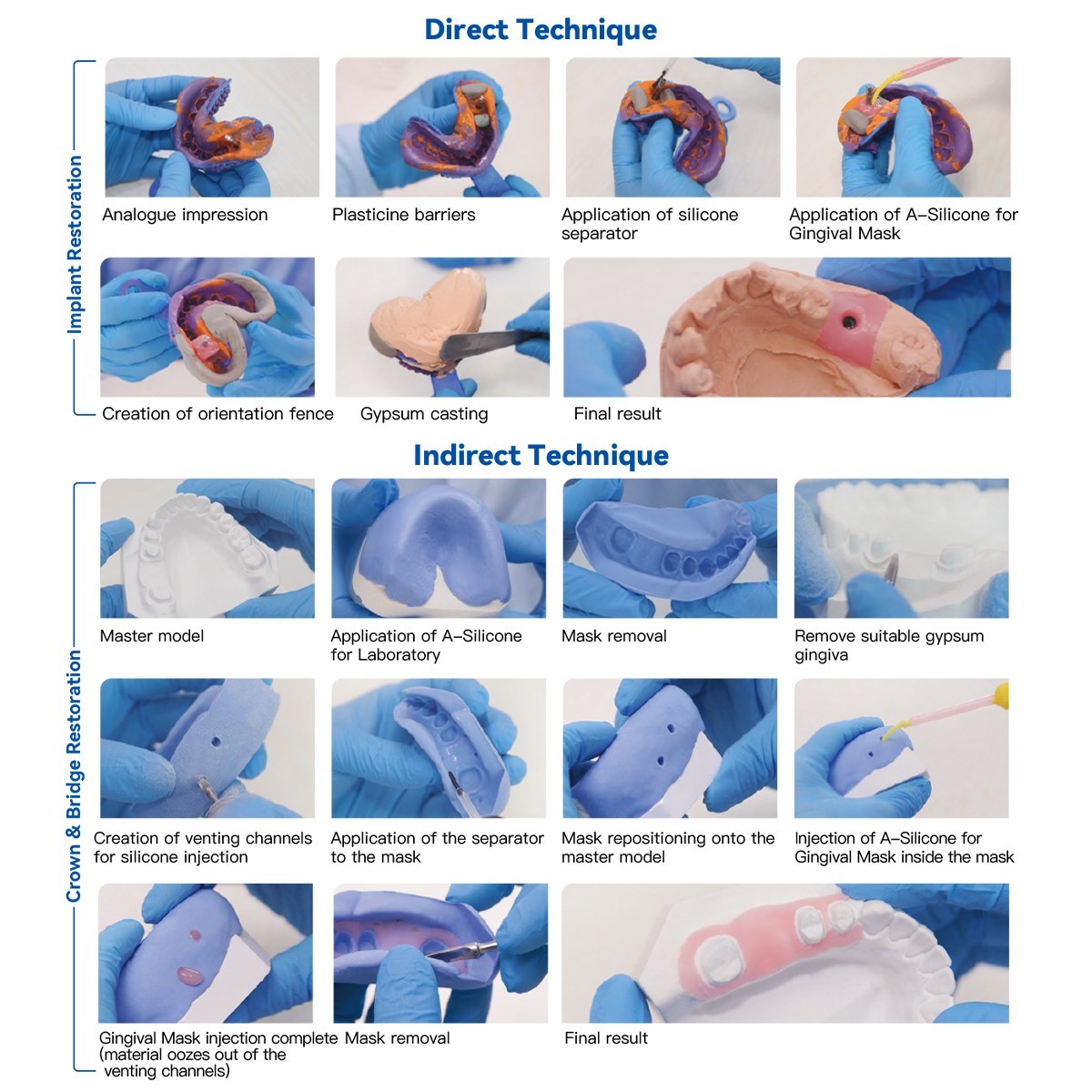 Dental Automix Flexible A-Silicone-Based for Gingival Mask Duplication Silicone