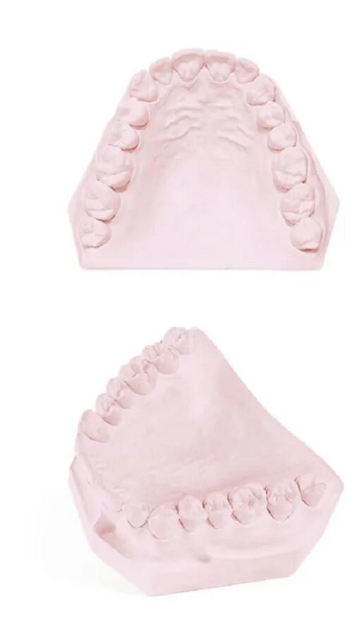 DENTAL LAB GYPSUM DIE STONE TYPE IV PINK ALL PURPOSE STRONG COMPOUND 5 Lbs.