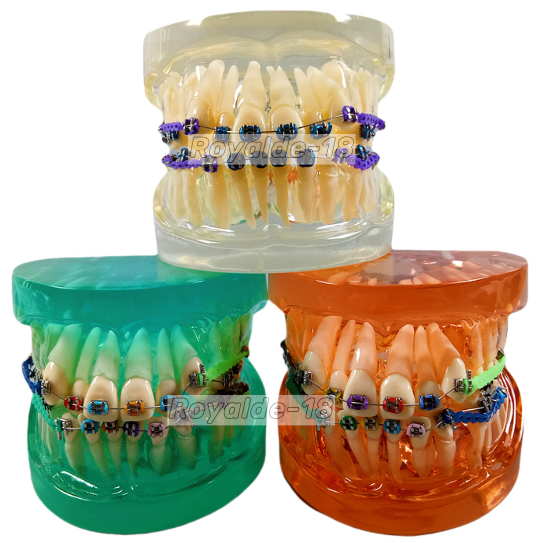 DAMON 30Packs Dental Orthodontic Arch Wires Stop Copper Cu-Niti Study Model Wire