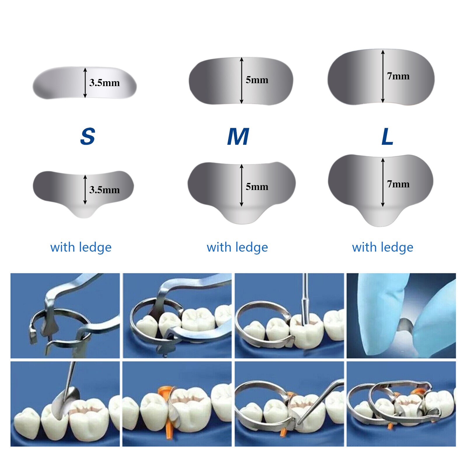 35μm Dental Metal Matrices Bands Matrix Sectional Contoured soft bands [US]S/M/L