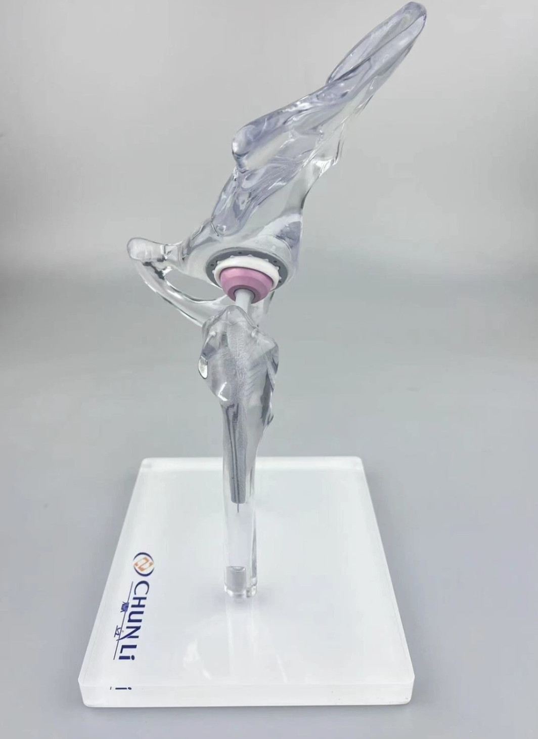 Transparent 1/3 Artificial Hip Joint Replacement Medical Anatomical Demo Model