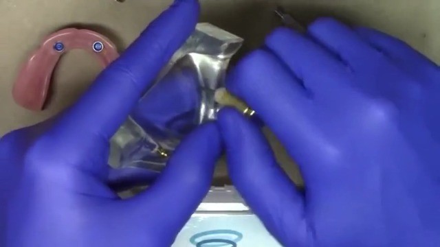 Replacement Male Retention Inserts Caps for IQ Implants – Standard, Light Retent