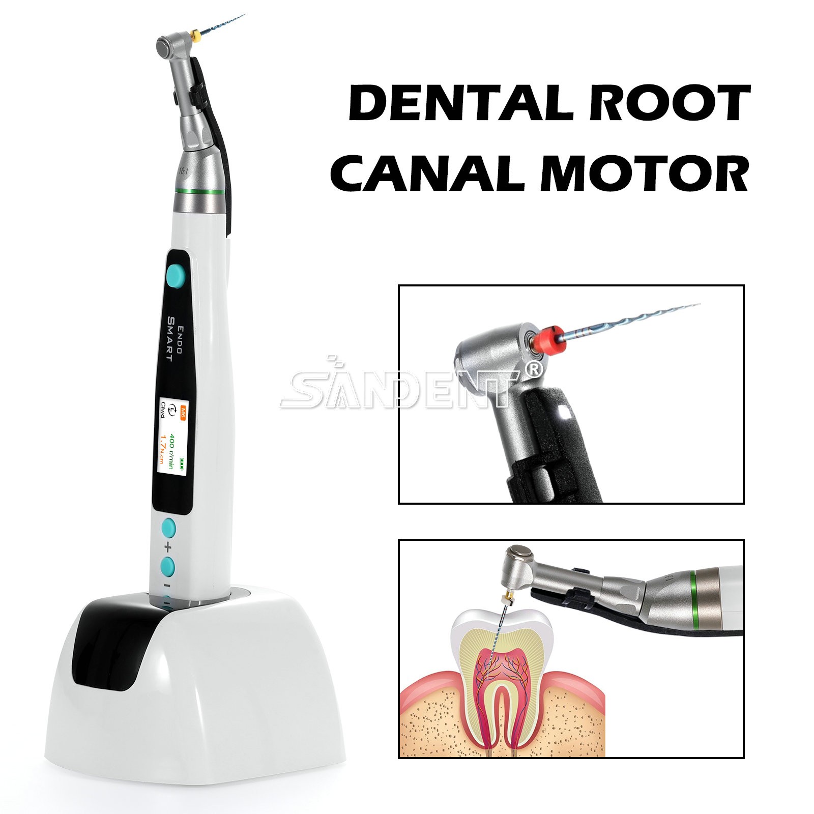 Smart Reciprocating LED Dental Endo Motor Root Canal Cordless / 1:1 16:1 Head