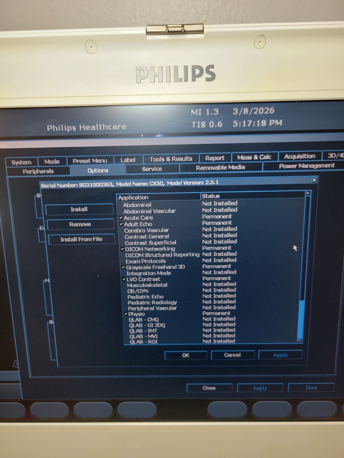 Philips CX50 Ultrasound System w/ Cart S5-1 & L12-3 Probes + Sony Printer Echo