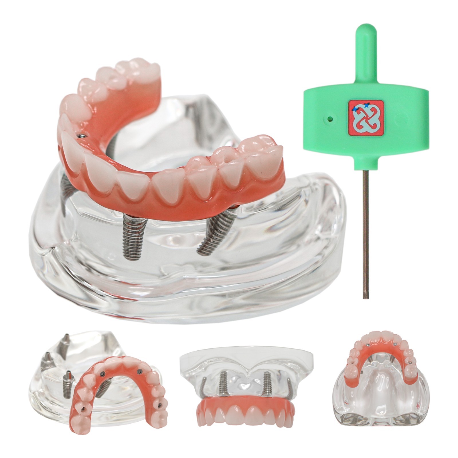 All-On-4 Dental Implant System Overdenture Treatment Teeth Model U/L Jaw W/screw