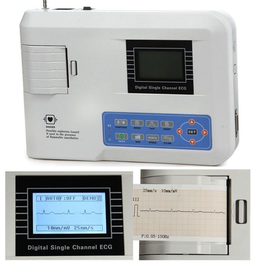 12-Lead Digital ECG/EKG Machine – 1-Channel Portable Monitor with Printout