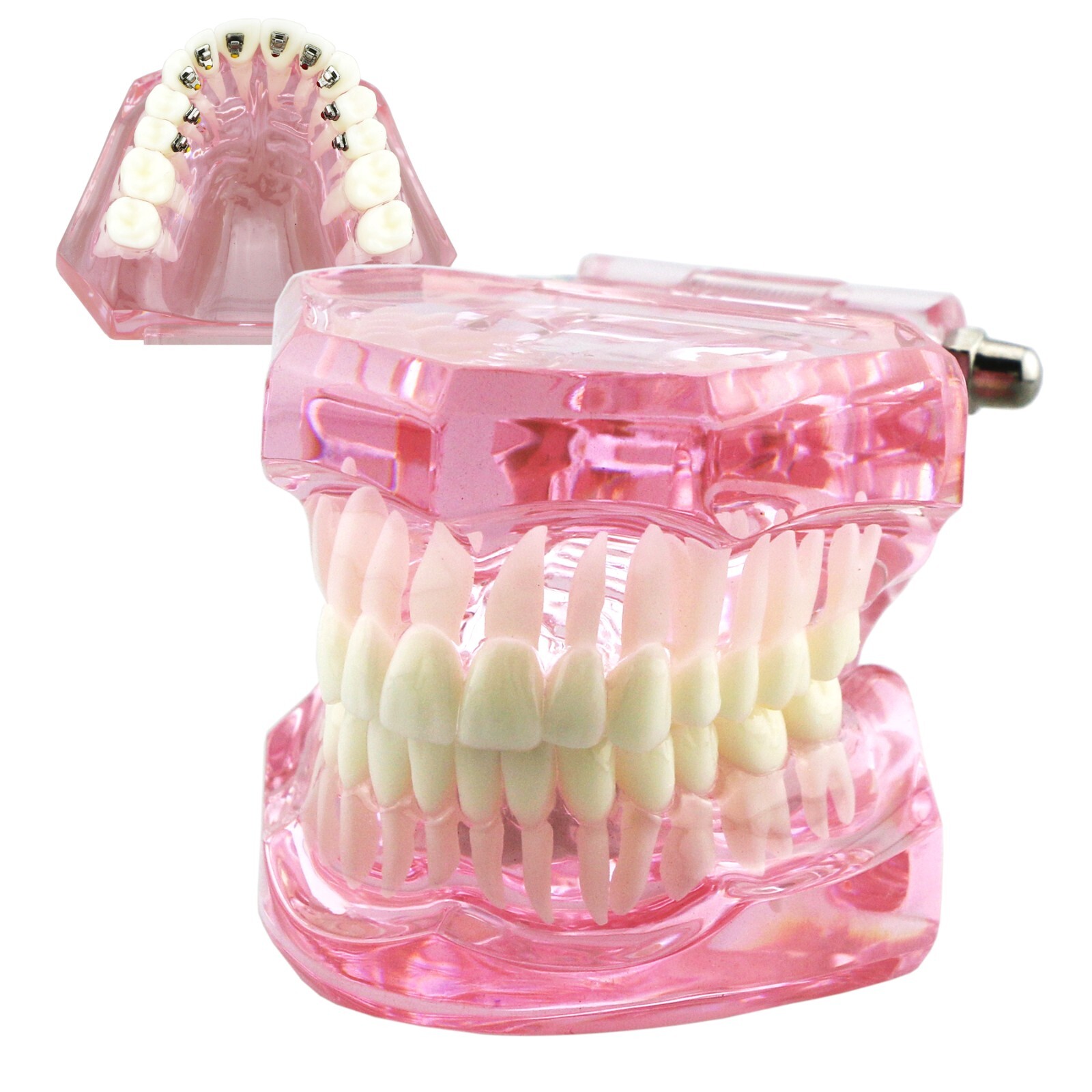 Dental Typodont Orthodontic Teeth Model With Metal Ceramic Brackets Retainer