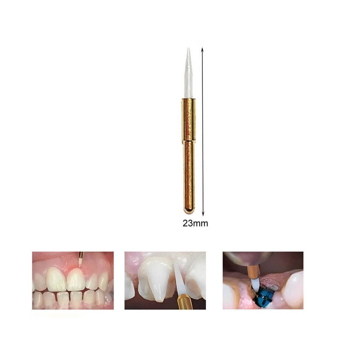 Dental Soft Trimmer Soft Tissue Burs For Gingival Retraction FG 21mm/23mm