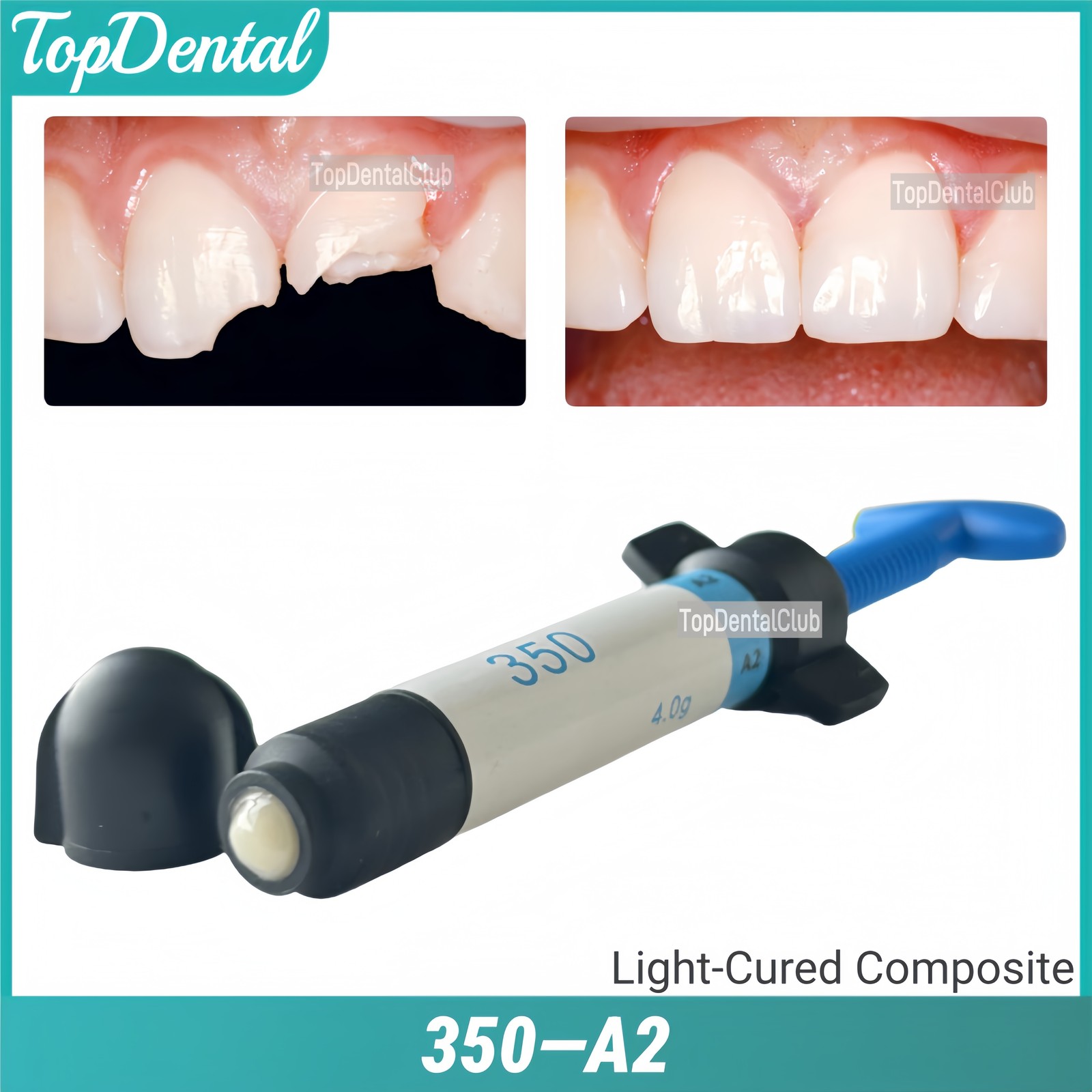350 A2 Dental Light Cure Composite Resin Veneer Whitening Teeth Restoration 4g