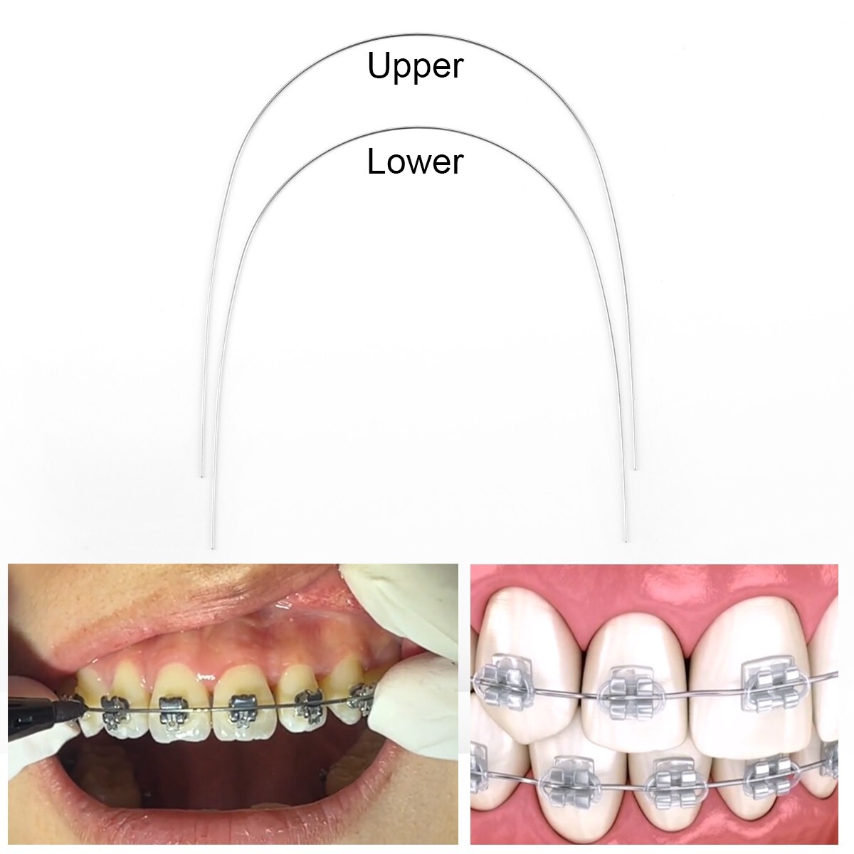 AZDENT Dental Ortho Bracket Braces Mini Roth.022 Hook 345/Arch Wire Nature Round