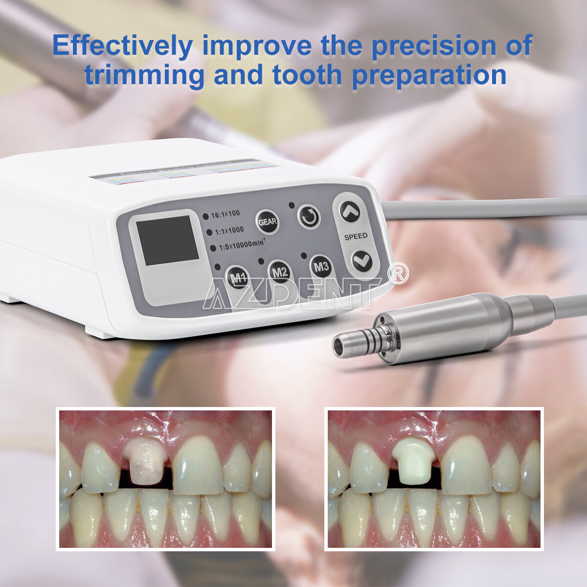 AZDENT Dental Electric LED Brushless Micro Motor/1:1/1:5 Increasing Handpiece