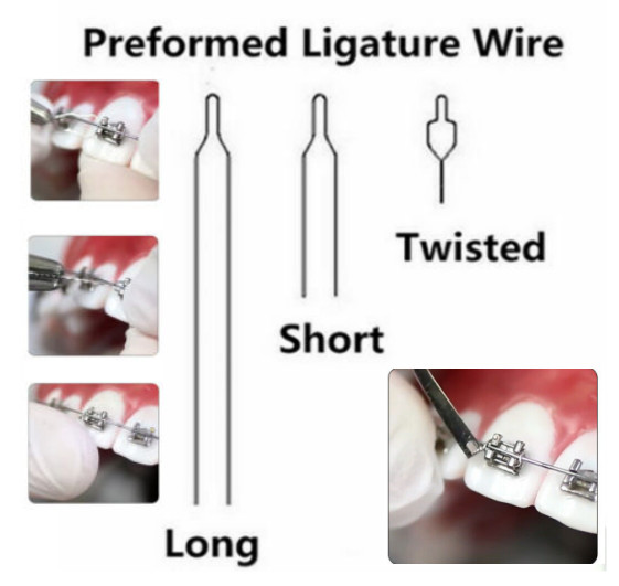 100pcs Dental Orthodontic Wire Kobayashi Preformed Ligature Tie Long Short Twist