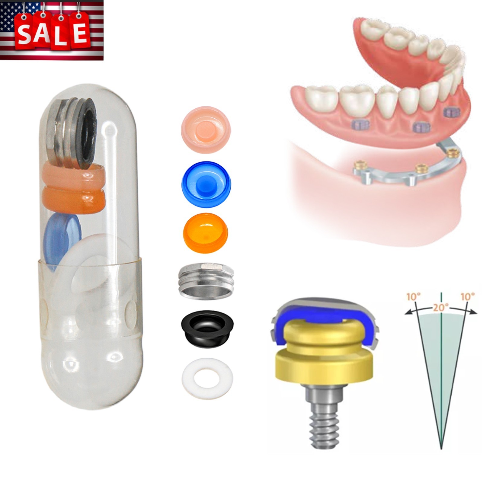 Fit Straumann ITI Healing & Locator Abutment Impression Transfer Analog Scanbody