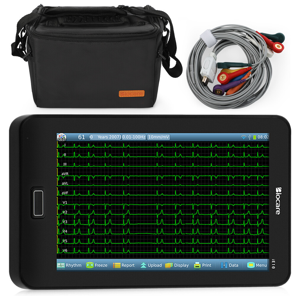 Portable 12 Lead ECG Machine Auto interpretation Analysis for STEMI Detection US