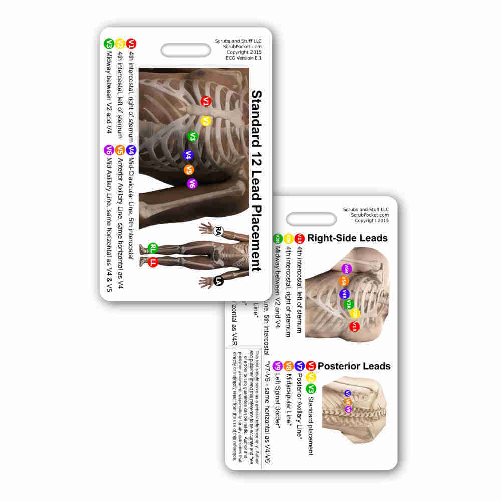 EKG 12 Lead Placement Vert Ref. Badge Card ID Pocket Guide Quick Cheat Sheet