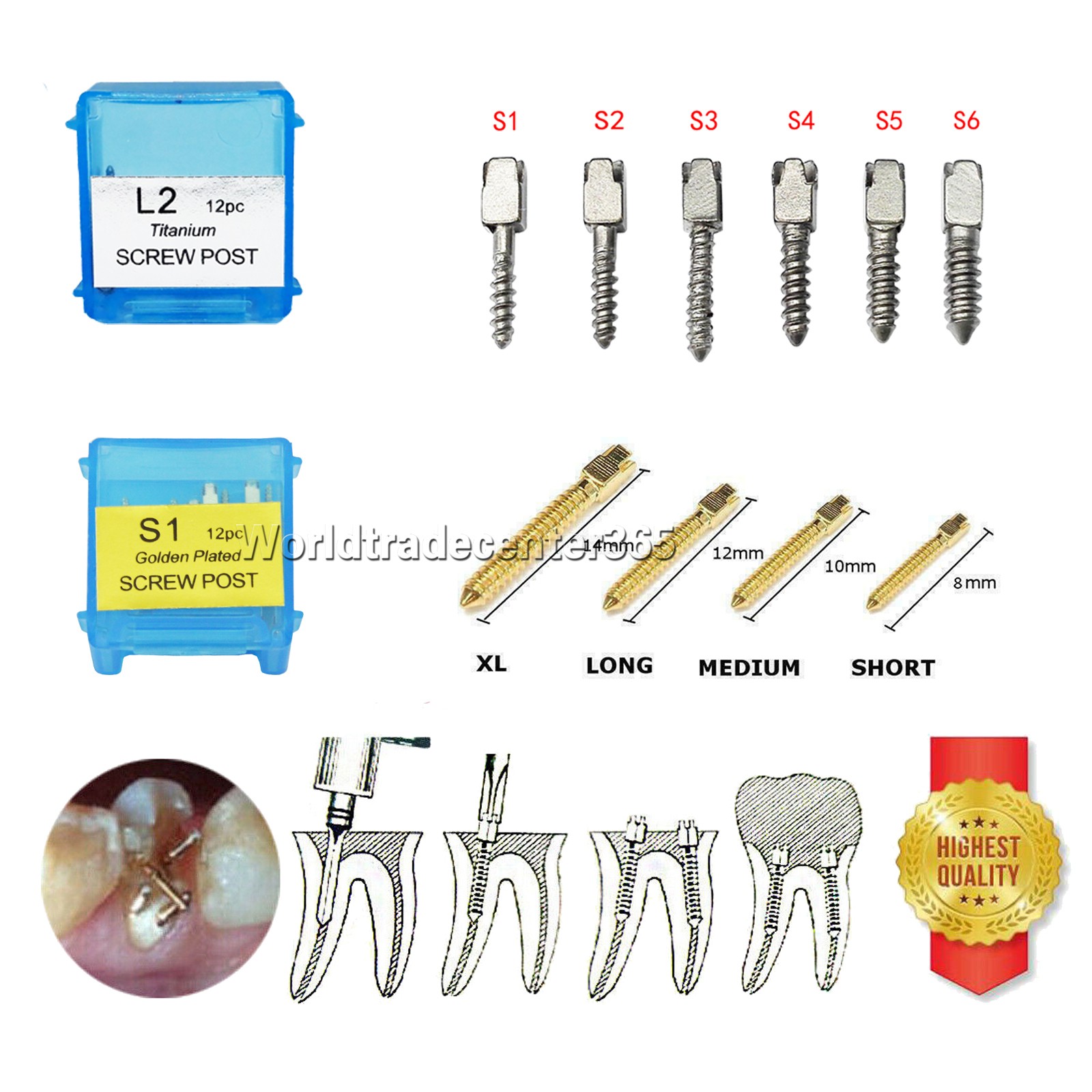 Dental Endodontic Screw Posts Kit SST/24K Gold Plated/Pure Titanium Nordin Type