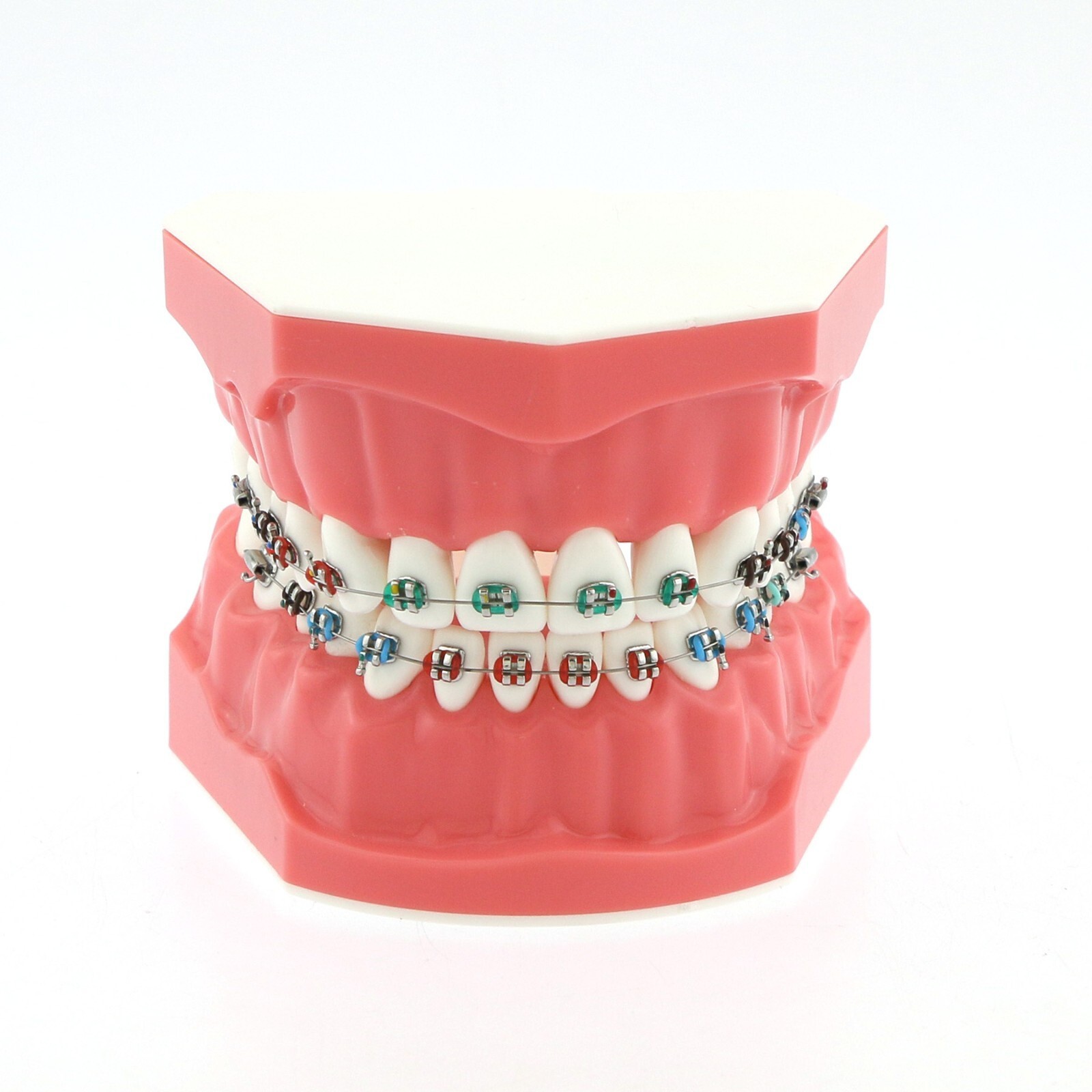 Dental Teeth Model Typodont Demonstration with Braces For Patient Study M7010-2
