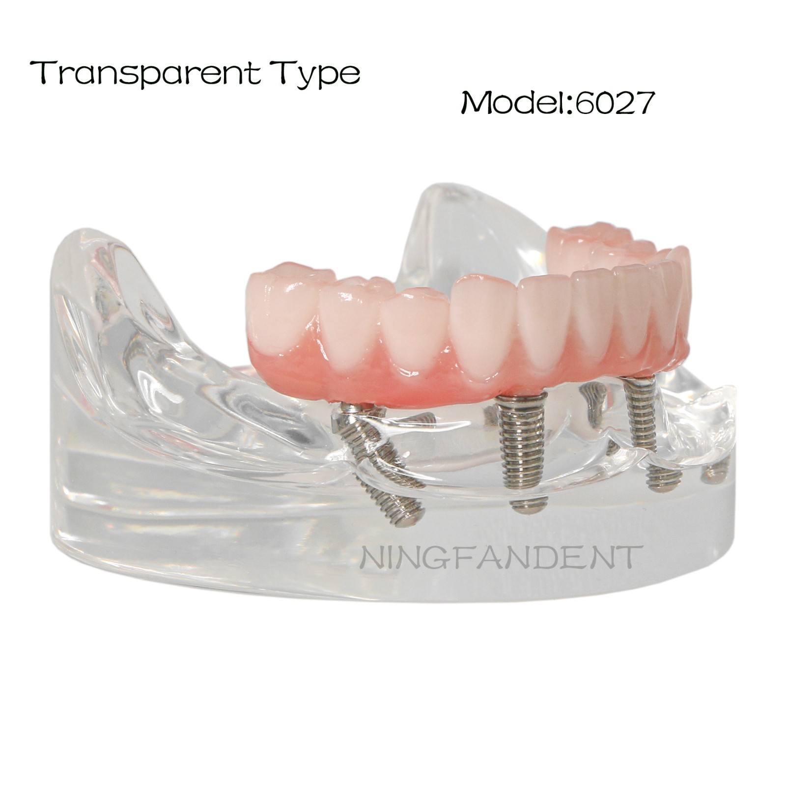 All-On-4 Dental Implant System Overdenture Treatment Teeth Model U/L Jaw W/screw