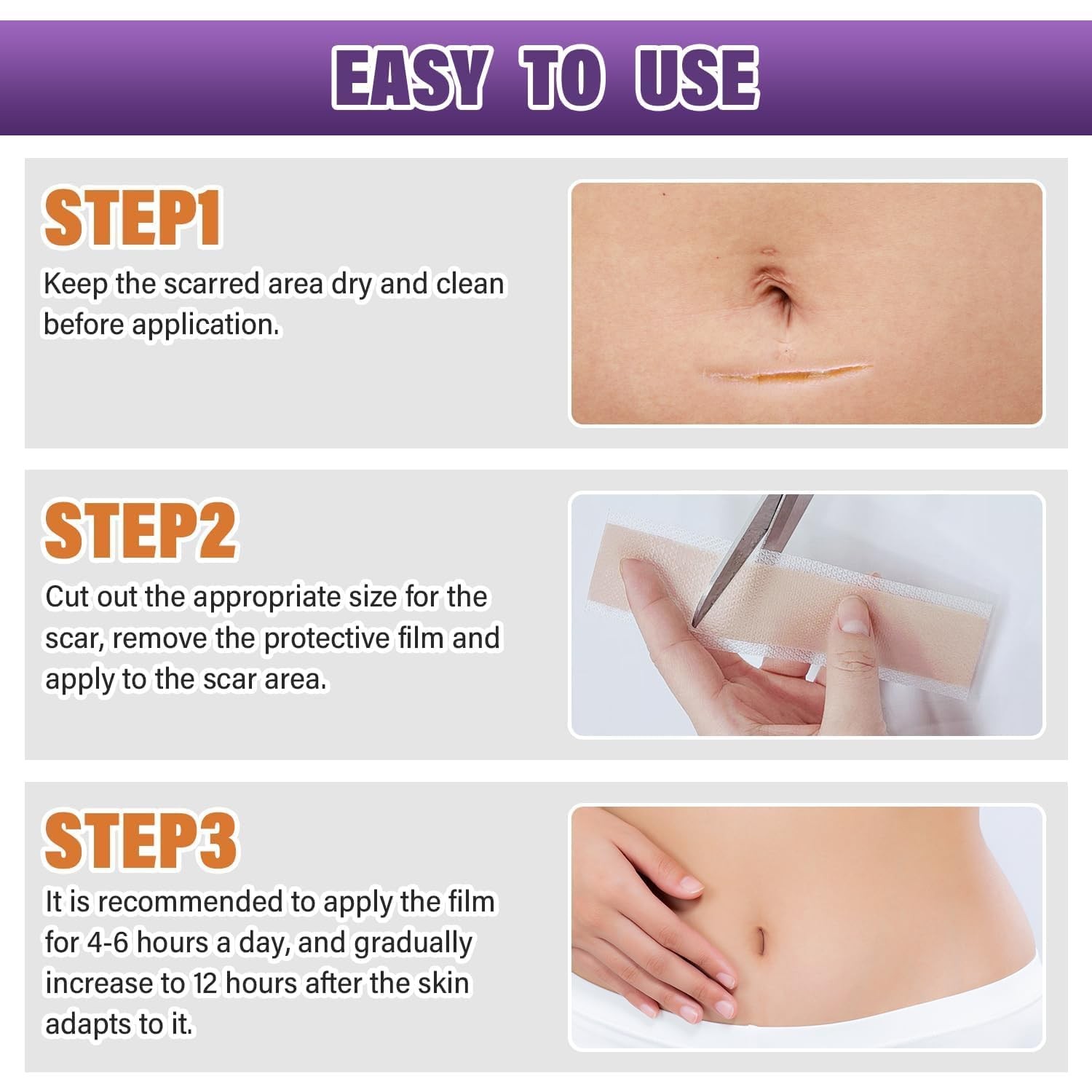 Psecici Silicone Scar Sheets Medical Grade Silicone Scar Tape For Surgical