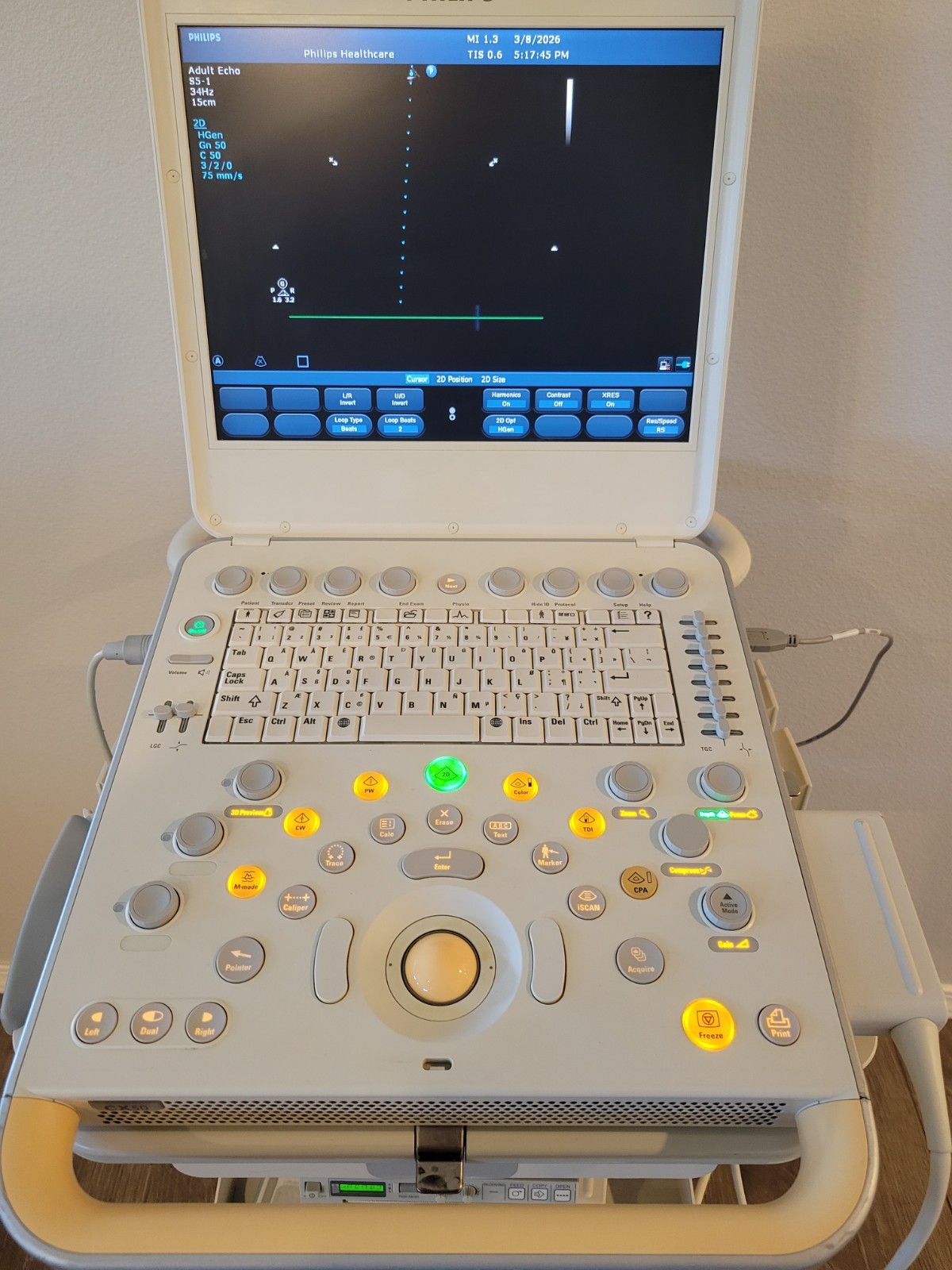 Philips CX50 Ultrasound System w/ Cart S5-1 & L12-3 Probes + Sony Printer Echo