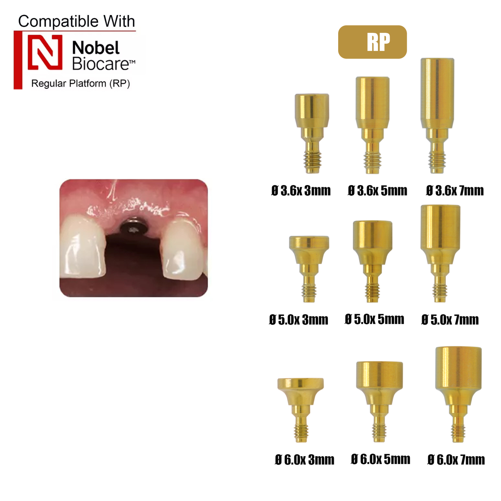 Hiossen/Nobel/Straumann Open/Closed Tray Posts Healing & Locator Abutments Caps