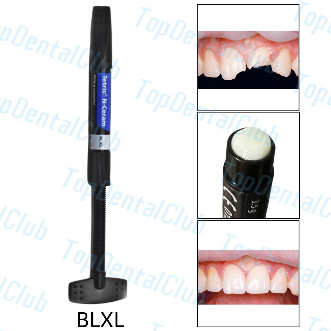 BLXL Dental Tetric N-Ceram Composite Resin BL XL Bleach Color Whitening Veneer