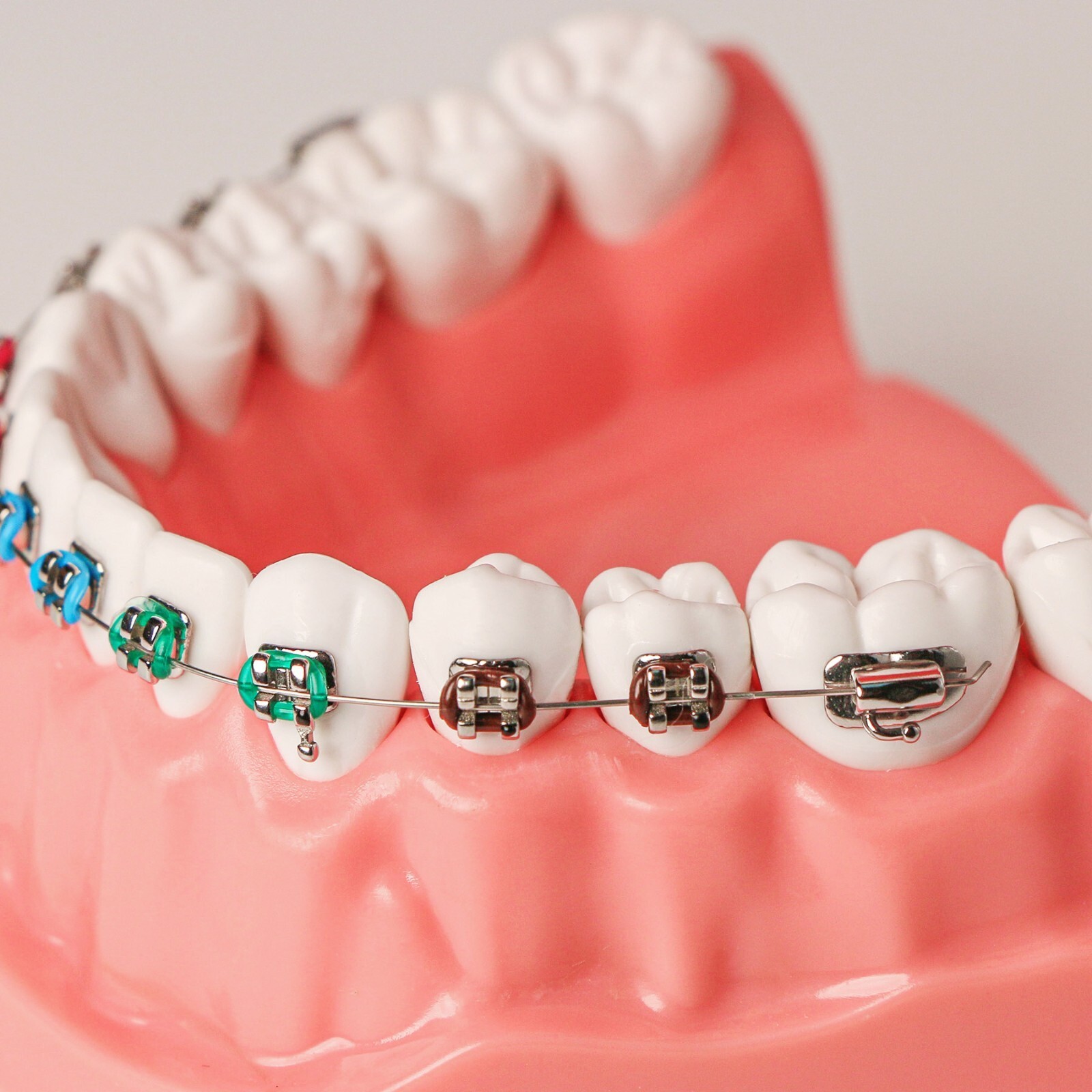 Dental Teeth Model Typodont Demonstration with Braces For Patient Study M7010-2