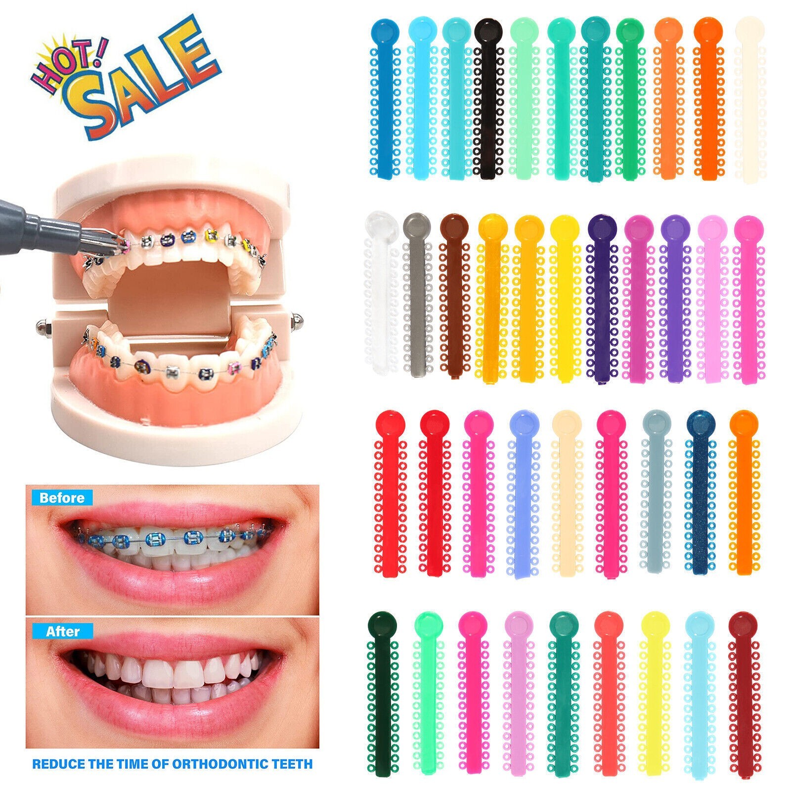 Dental Orthodontics Ligature Ties Elastic Rubber Bands Mixed Color 4 Types