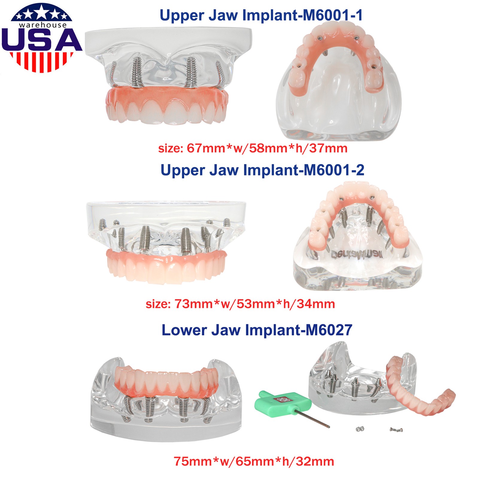 US Dental Overdenture/Implant/Orthodontic Typodont Ortho Training Teaching Model