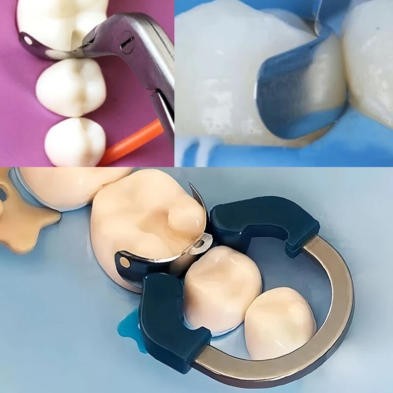 Dental Matrix Bands Ring Sectional Matrice Clamp Wedges Fit Palodent V3 System