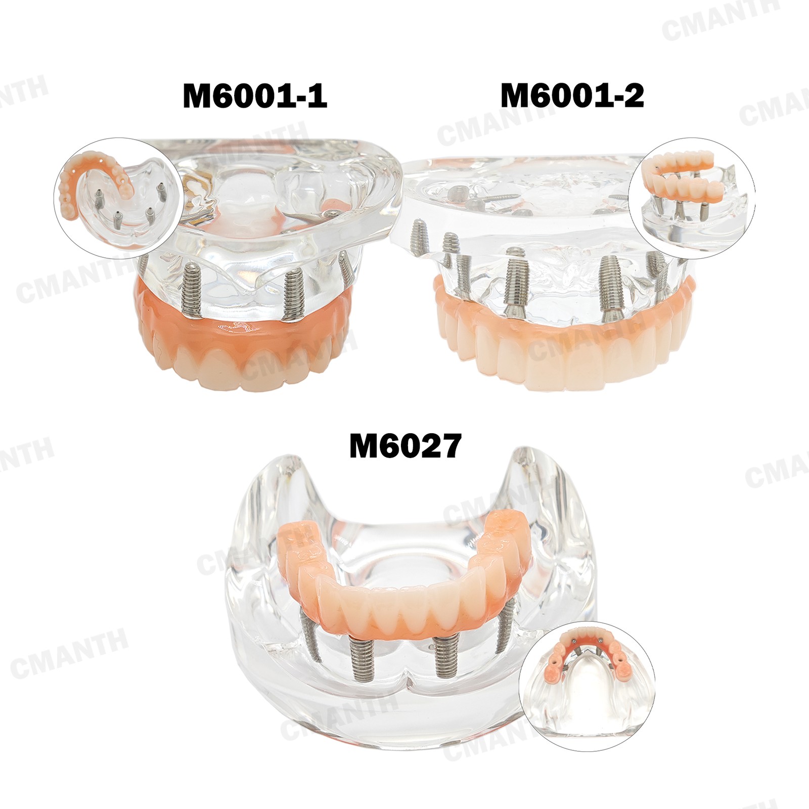 Multiple Types Dental Teeth Model Ortho Implant Pathological Perio Practice Demo