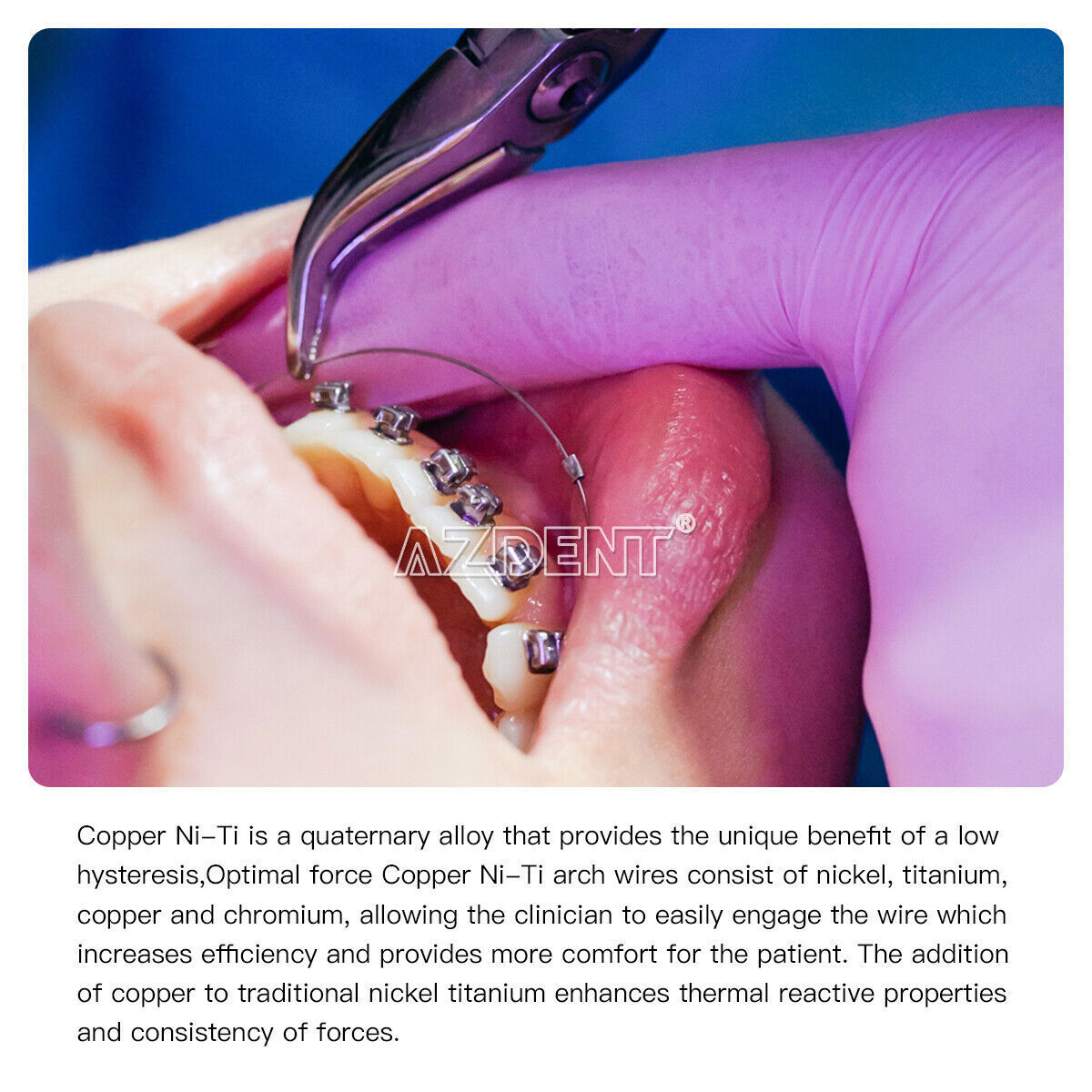 dental rectangular arco cable súper elástico de cobre cu-niti paradas preformada