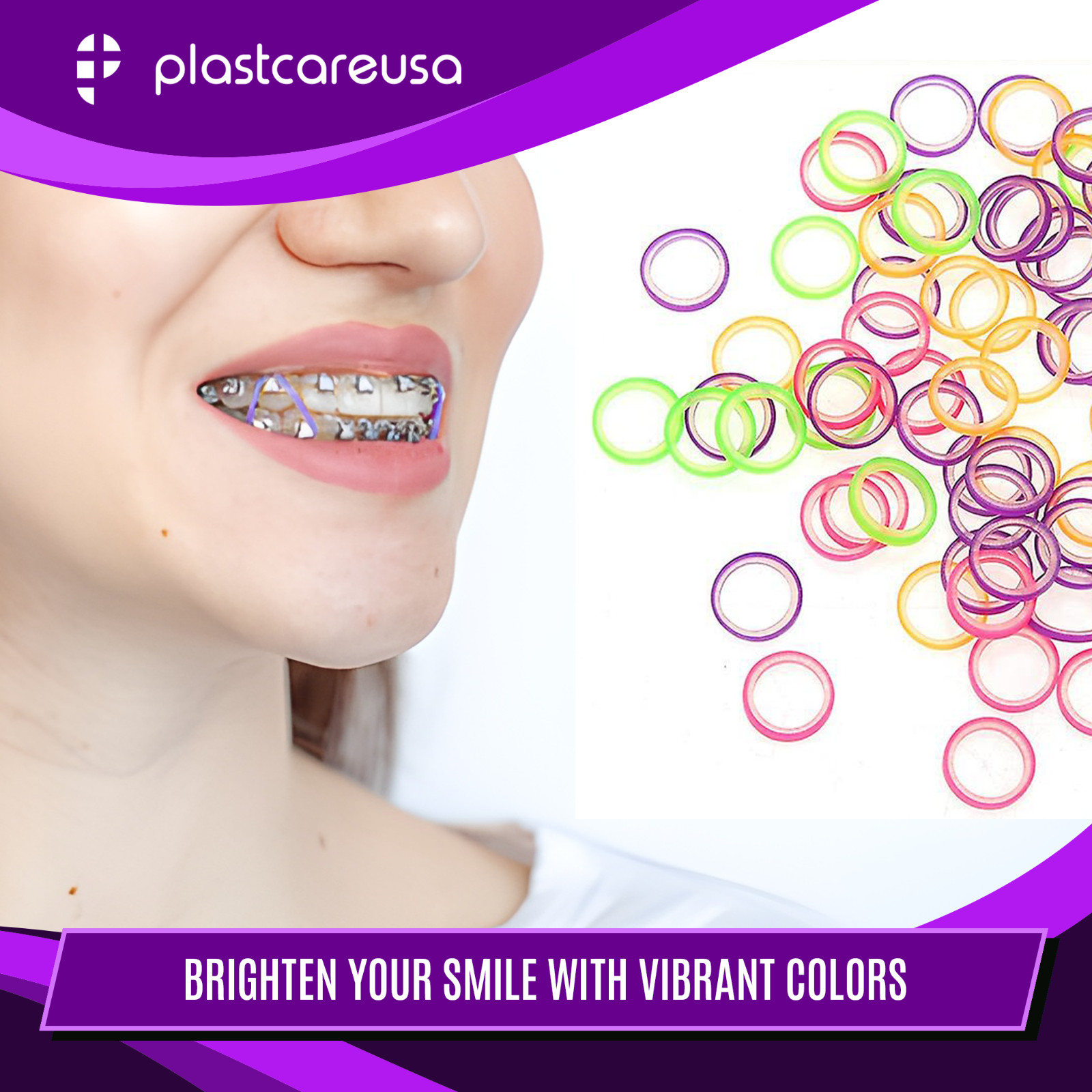 100 Assorted Color Light 3.5 Oz 1/4″ Fox Latex Elastic Rubber Bands Braces