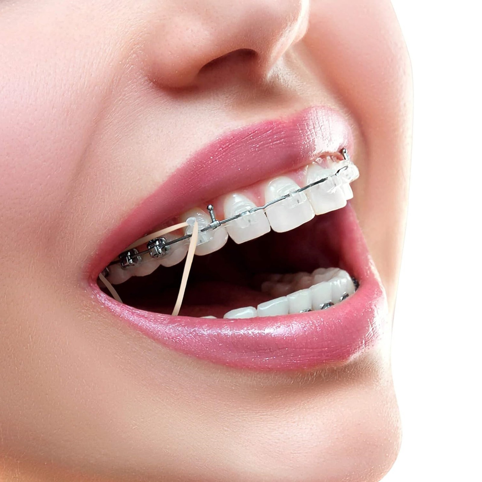US Dental Orthodontic Elastics Braces Rubber Bands latex Light Force 3.5OZ