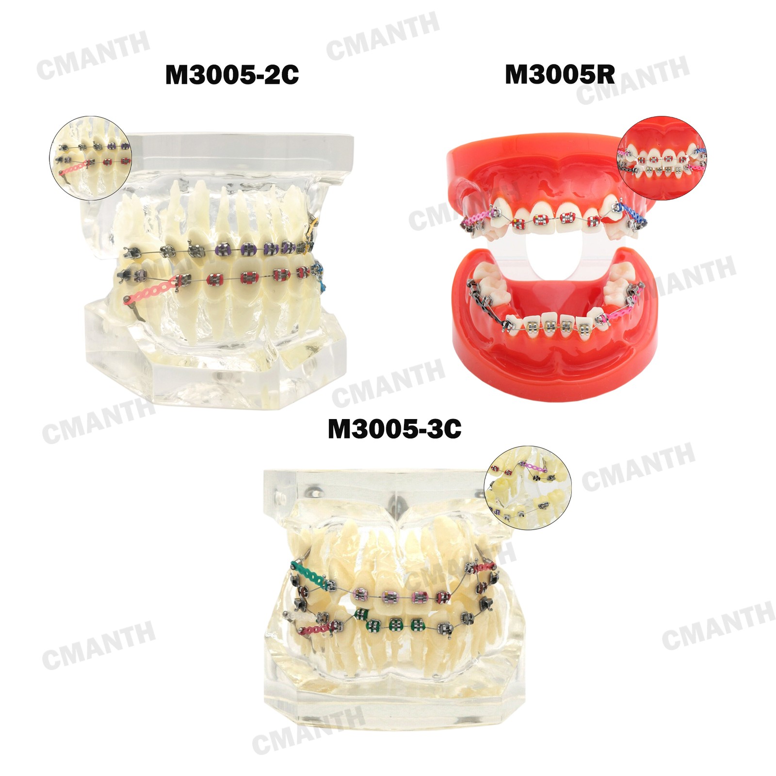 Multiple Types Dental Teeth Model Ortho Implant Pathological Perio Practice Demo